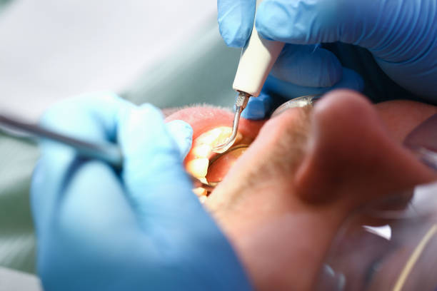 Best Pediatric Emergency Dentist in Pepper Pike, OH